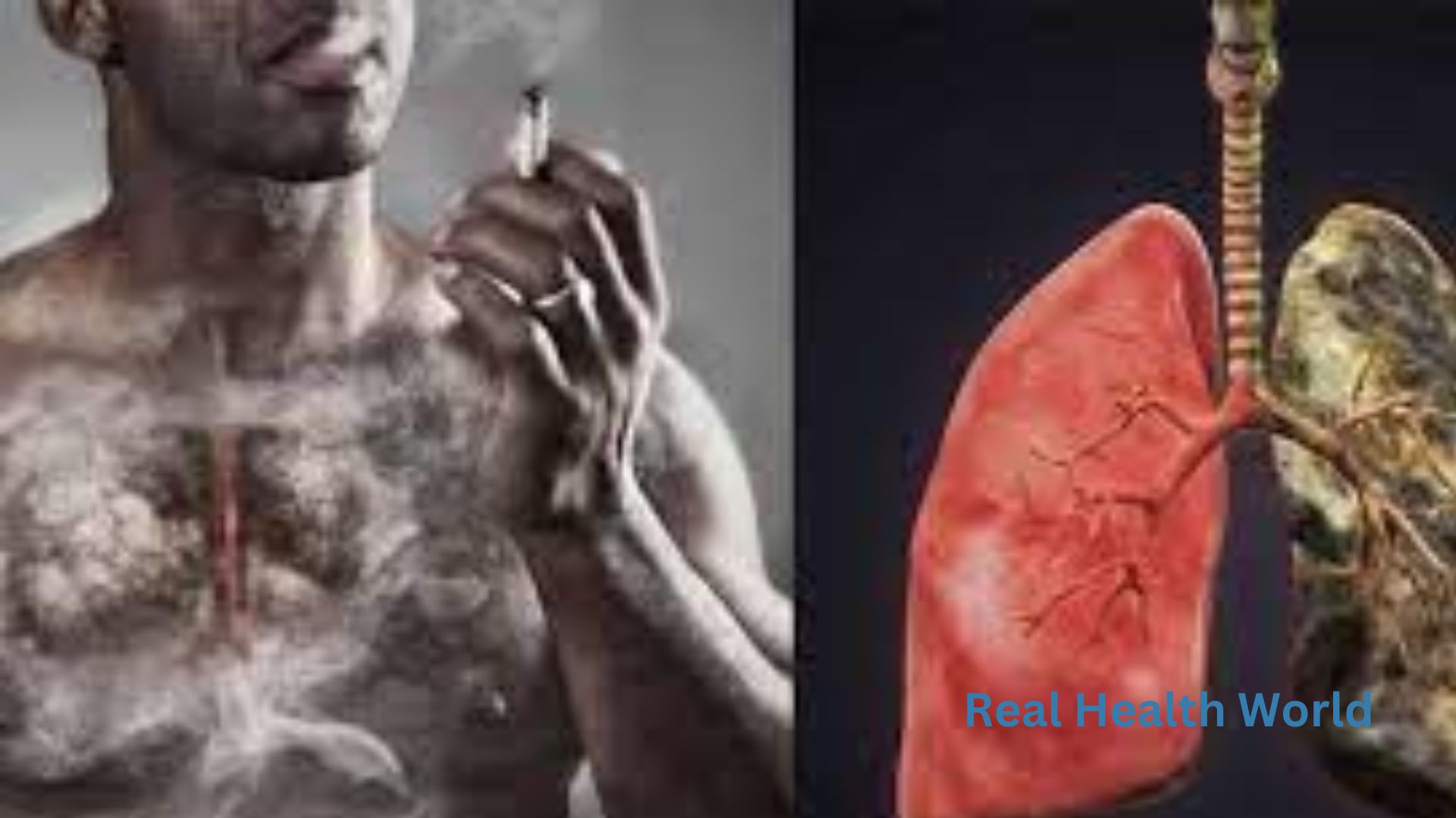 Do non-smokers have lung disease?