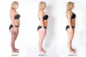 Bikini Belly Review – Does it Work?